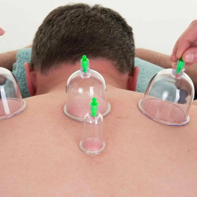 10PCS Cupping Therapy Set for Massage and Wellness, Vacuum Suction Cupping Kit for Muscle Relaxation, Pain Relief & Detox - Alcohol Free, Manual Operation Without Batteries